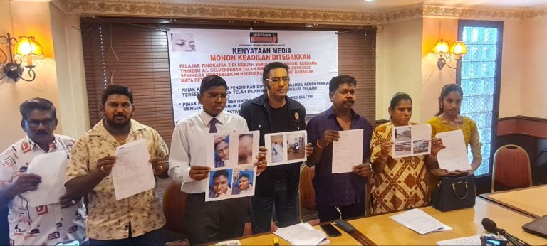 Dibelasah rakan sekolah, pelajar tingkatan tiga hilang separuh penglihatan, terpaksa lupakan cita-cita jadi anggota polis